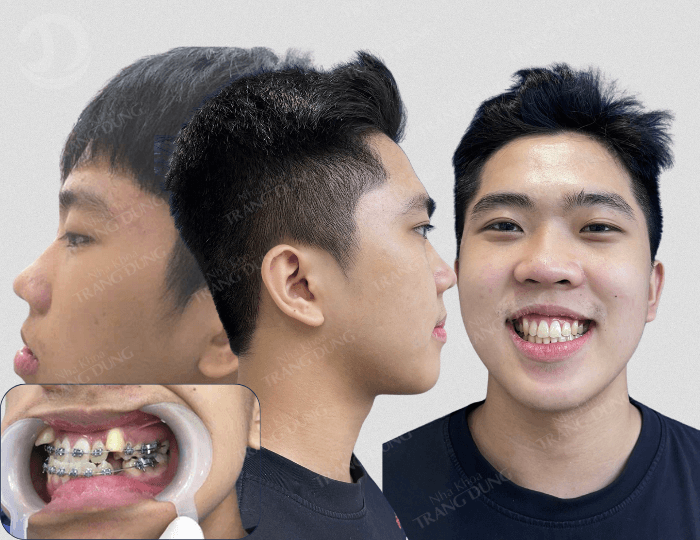 Thay đổi được ghi lại, qua một hành trình.