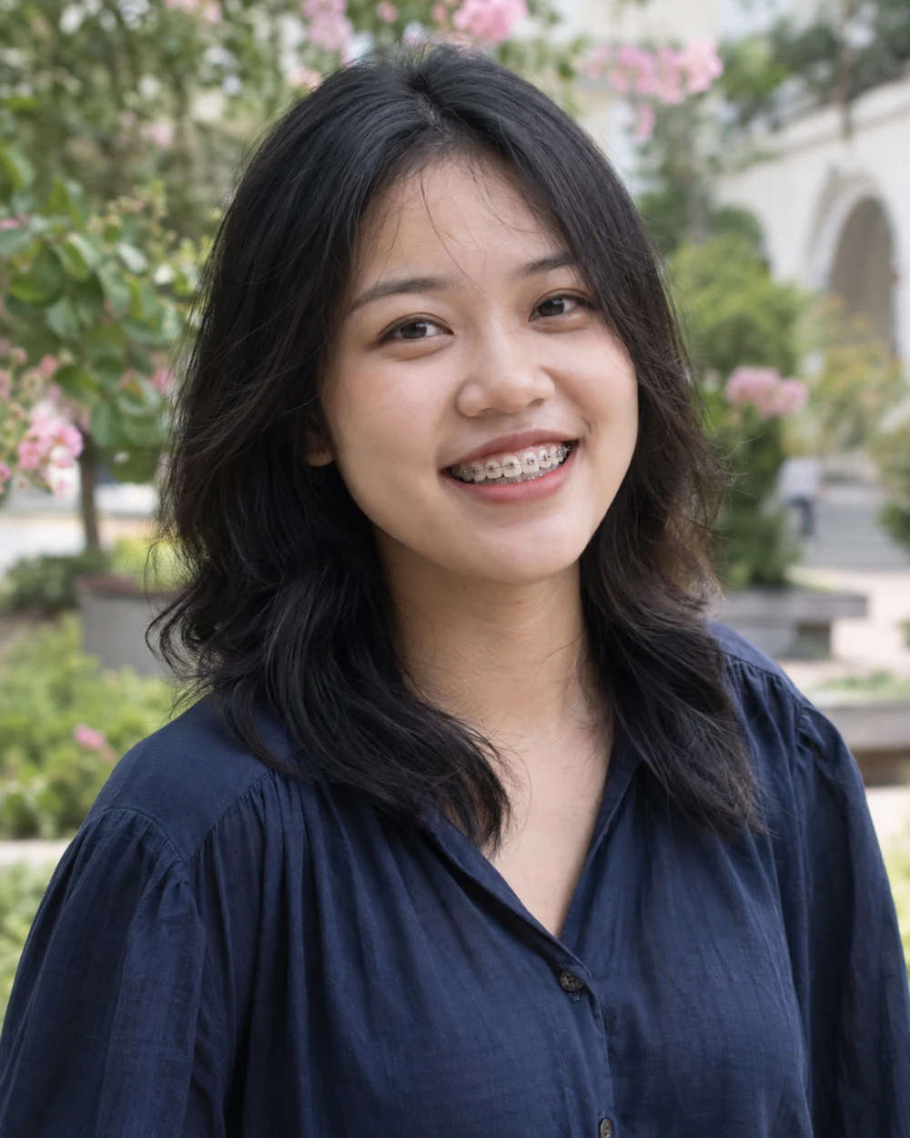 Sinh viên · Mắc cài kim loại