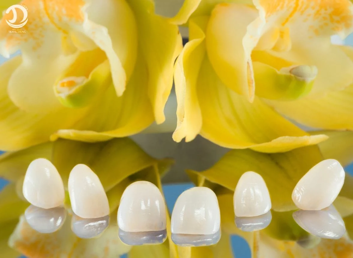 Six porcelain veneer shells with orchids; generic material, no verified brand
