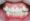 Răng khểnh thường gây ra nhiều bệnh về răng miệng
