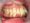 Răng hô gây nhiều bệnh lý về răng miệng