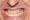 Hình ảnh đàn ông có hàm răng thụt vào trong tướng số 