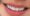 Răng sứ Lava có thiết kế giống răng thật 