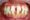 Răng bị đổi màu do mảng bám cao răng 