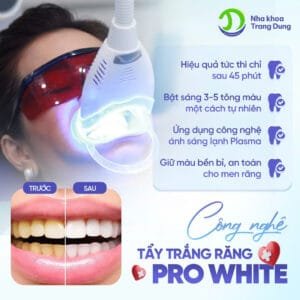 Hiệu quả của công nghệ nha khoa tẩy trắng răng pro White đang được ưu đãi 50%