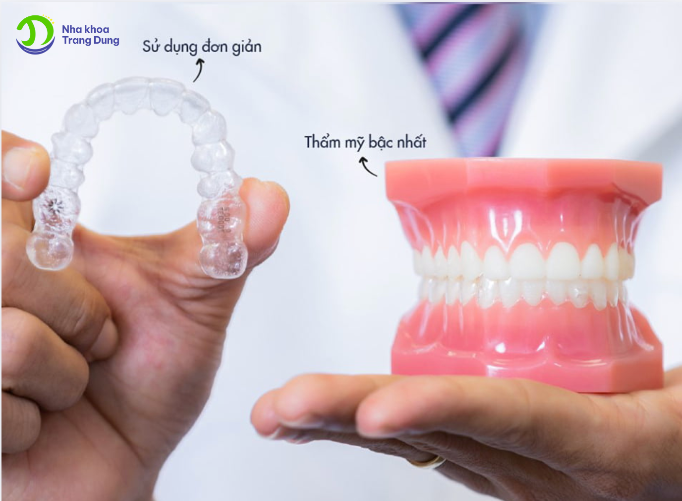 Khay niềng Invisalign có dễ sử dụng không?