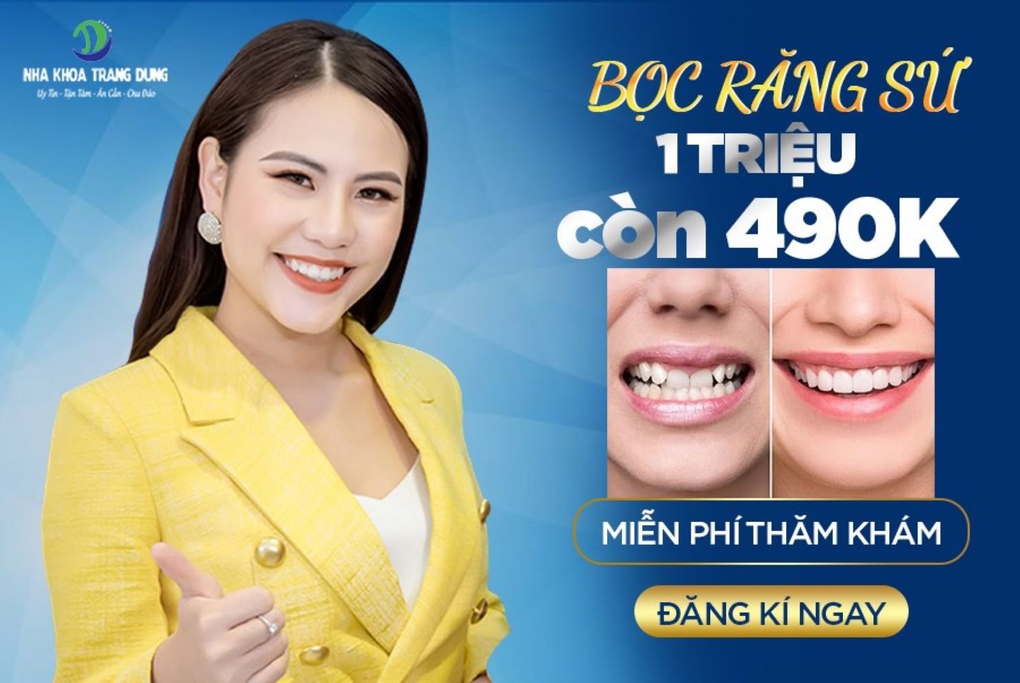 Nha khoa Trang Dung Bọc răng sứ thẩm mỹ