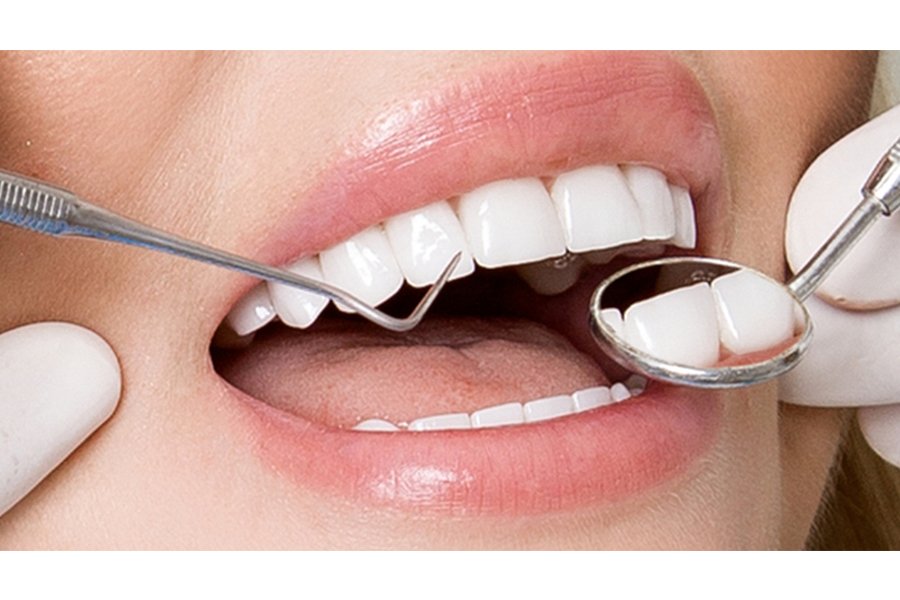 Trồng răng giả tháo lắp là gì? Ai nên làm và giá bao nhiêu? Trồng răng giả tháo lắp