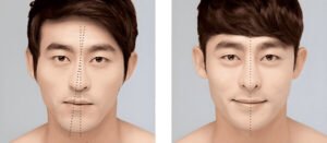 Khuôn Mặt Bị Lệch Khi Chụp Ảnh: Nguyên Nhân Và Cách Khắc Phục khuon mat bi lech khi chup anh