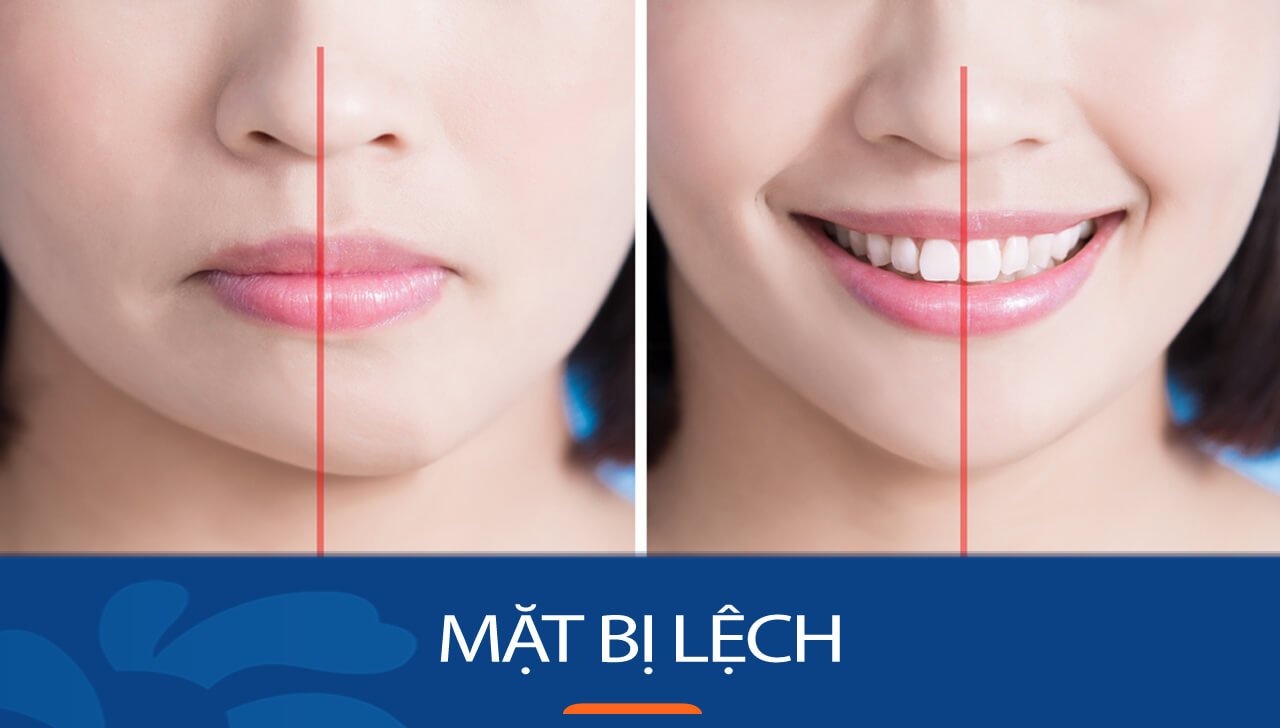 Khuôn Mặt Bị Lệch Khi Chụp Ảnh: Nguyên Nhân Và Cách Khắc Phục khuon mat bi lech khi chup anh