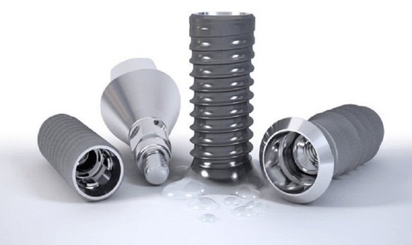 Làm răng implant giá bao nhiêu