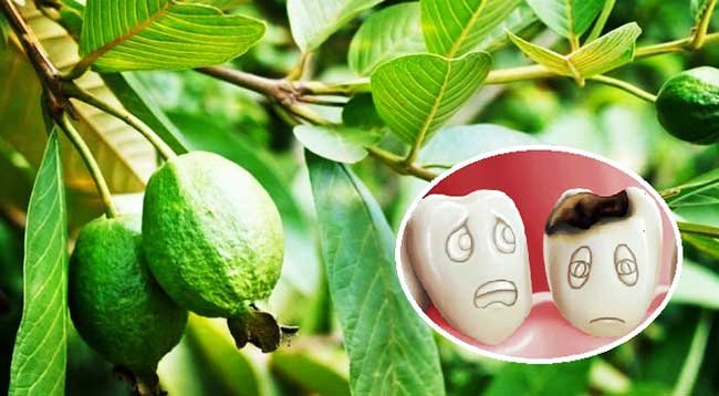 Mẹo chữa đau răng sâu