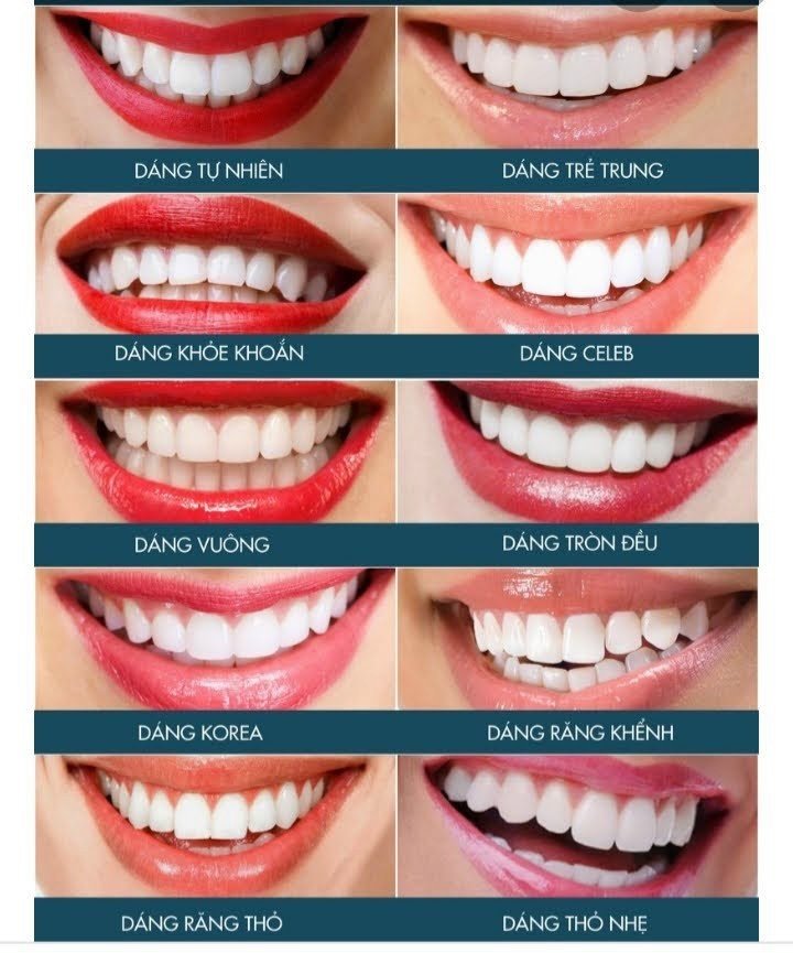 Bảng Giá Trồng Răng Implant Và Các Yếu Tố Quyết Định Chi Phí bảng giá trồng răng implant