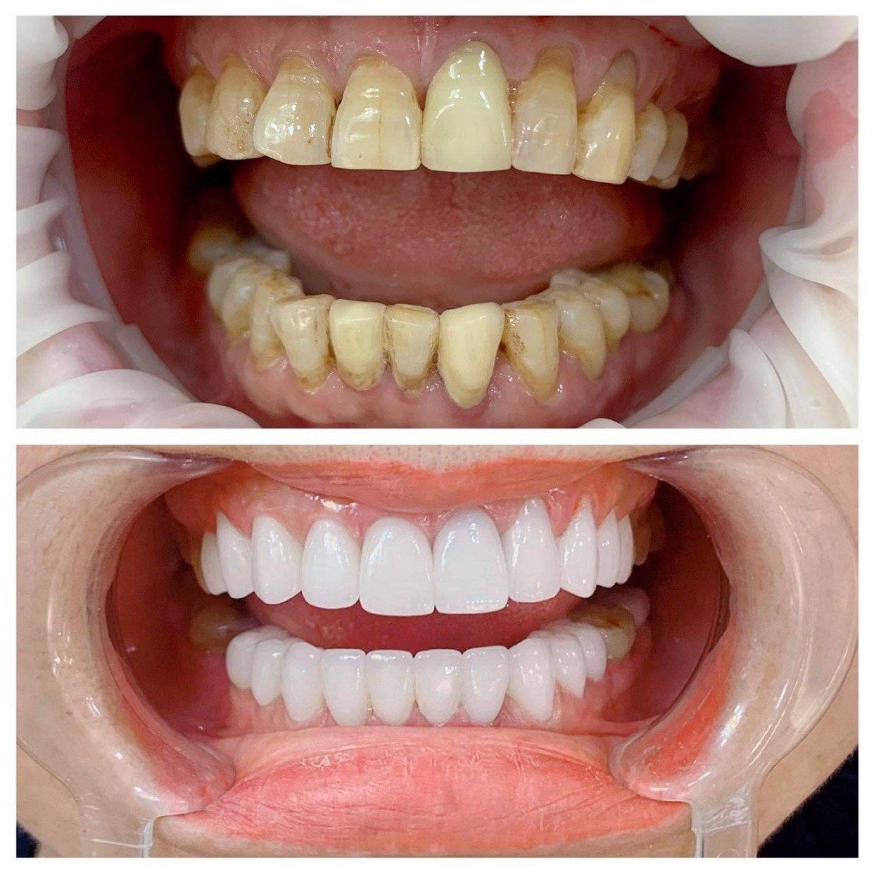 Review Các Nha Khoa Uy Tín Hà Nội Có Thể Bạn Chưa Biết nha khoa uy tín hà nội