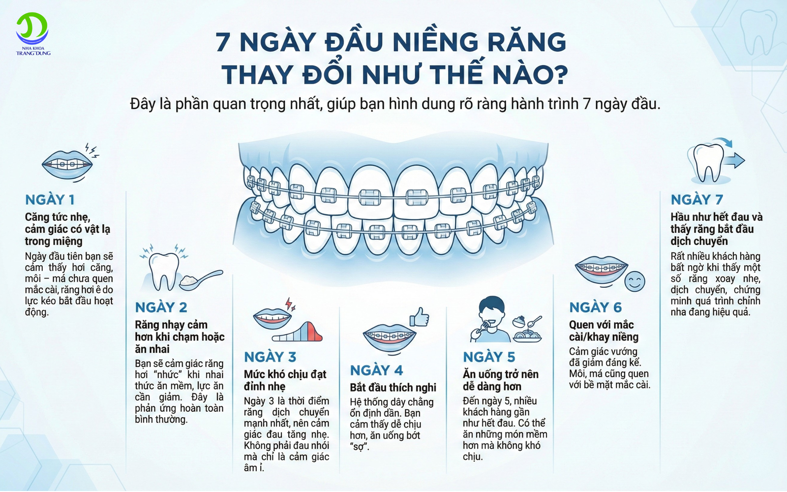 niềng răng