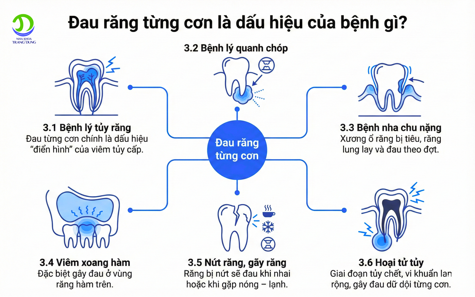 đau răng từng cơn là dấu hiệu của bệnh gì