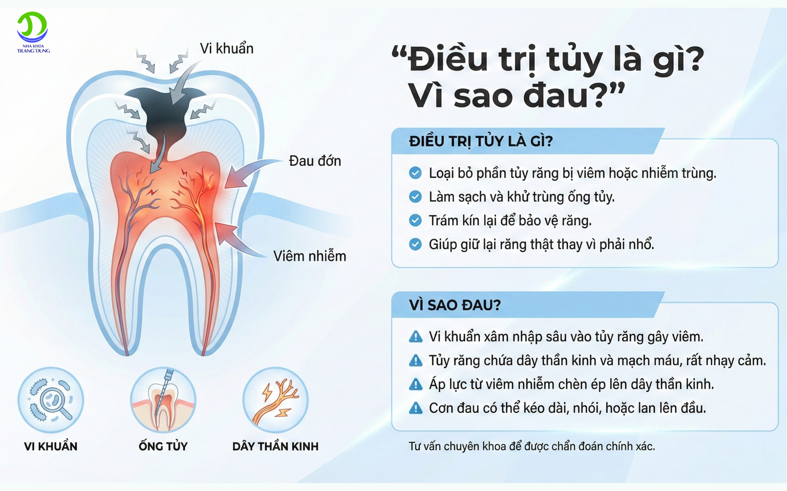 điều trị tủy viêm tủy răng