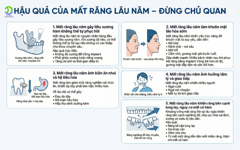 Mất răng lâu năm không còn là nỗi lo: Giải pháp phục hồi toàn diện giúp lấy lại nụ cười khỏe mạnh hậu quả mất răng