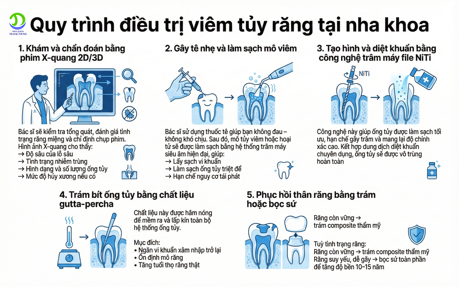 quy trình điều trị viêm tủy