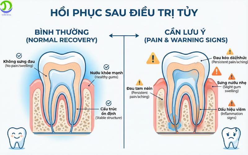 điều trị tủy