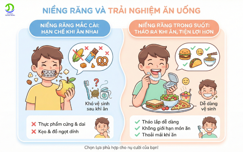 7 Điểm Khác Biệt Quan Trọng Khi So Sánh Niềng Răng Mắc Cài Và Niềng Răng Trong Suốt niềng răng