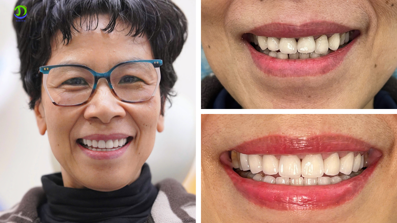 Tướng răng trong nhân tướng học