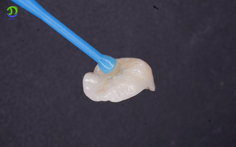 Điều trị tủy xong có cần bọc sứ không? bọc sứ