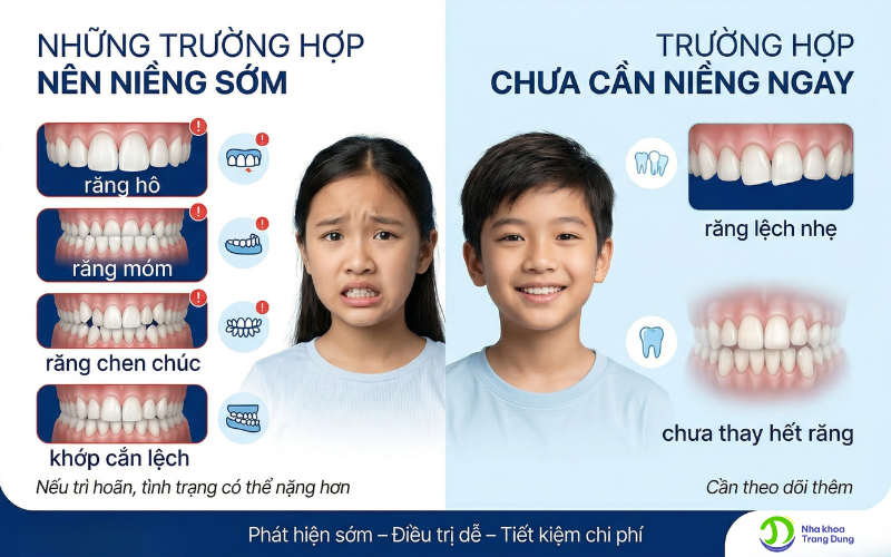 Những trường hợp nên và không cần niềng răng