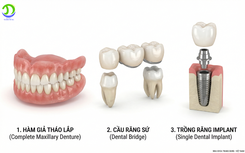 các loại hàm giả phổ biến