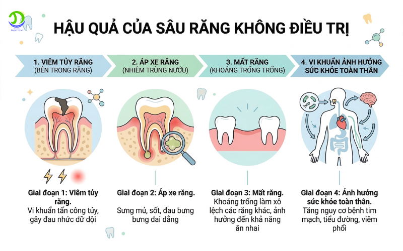 Hậu quả nếu không chữa răng sâu