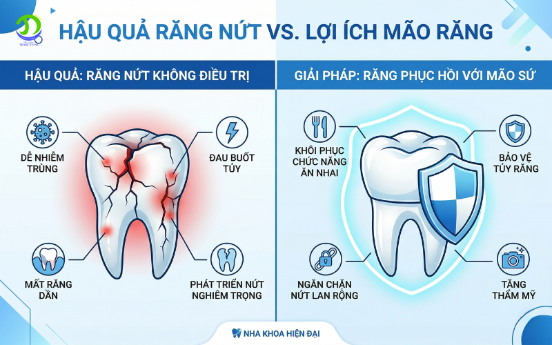 Điều trị tủy xong có cần bọc sứ không? điều trị tủy