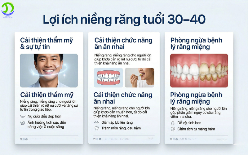 Niềng răng cho người lớn 30–40 tuổi có hiệu quả không? lợi ích niềng răng ở tuổi 30-40
