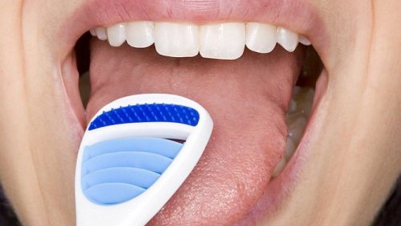 Cách làm sạch lưỡi bị trắng