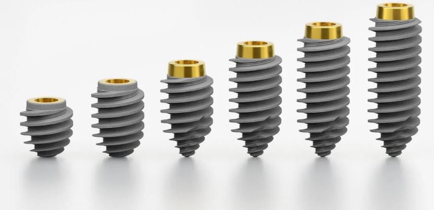 Cùng Tìm Hiểu Làm Răng Implant Giá Bao Nhiêu 2026? làm răng implant giá bao nhiêu