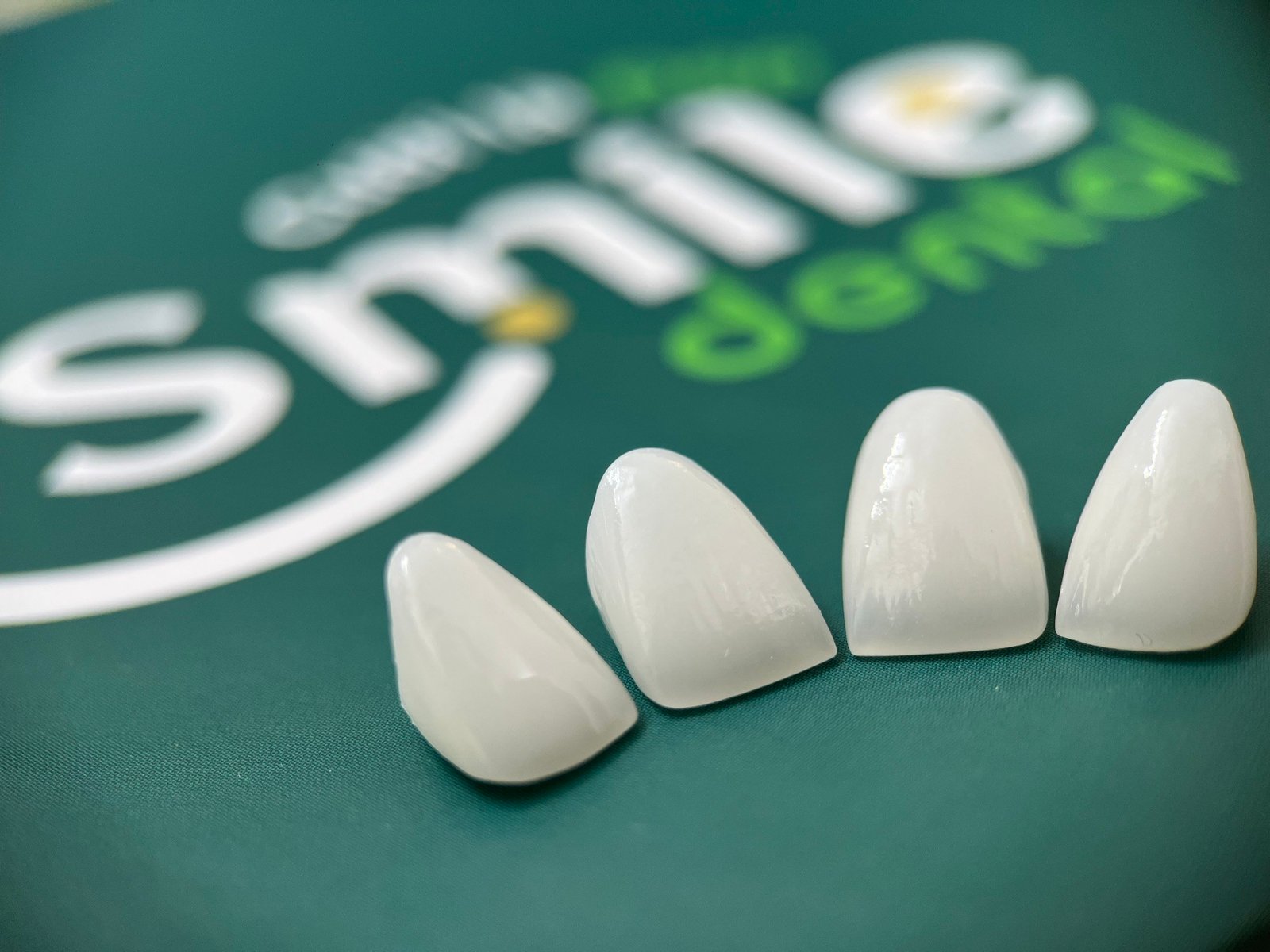 giá làm răng implant​