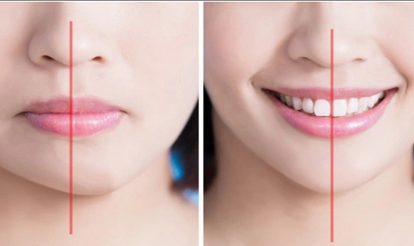 Khuôn mặt bị lệch khi chụp ảnh