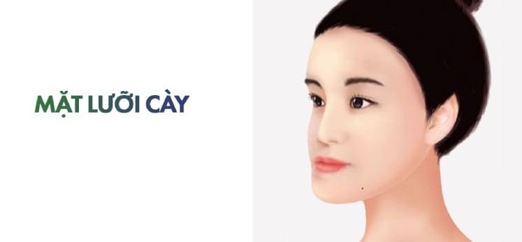 Mặt lưỡi cày là gì