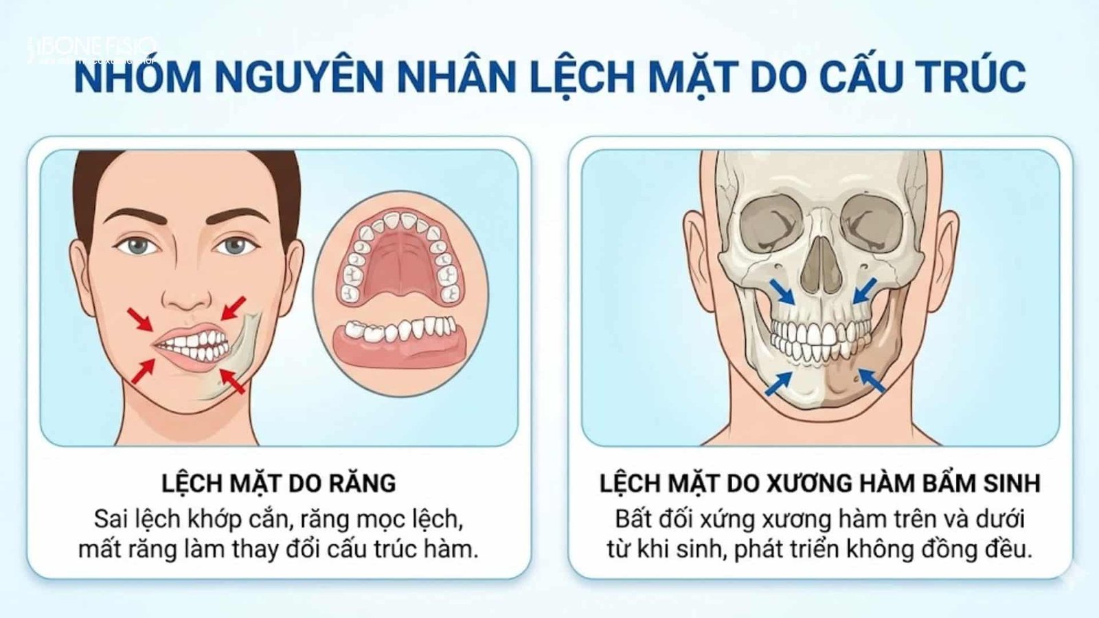 Khuôn mặt bị lệch khi chụp ảnh: Nguyên nhân và cách khắc phục Khuôn mặt bị lệch khi chụp ảnh