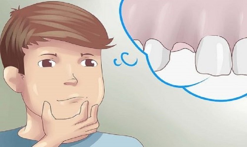 Nằm mơ thấy gãy răng​