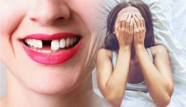 Nằm mơ thấy gãy răng​