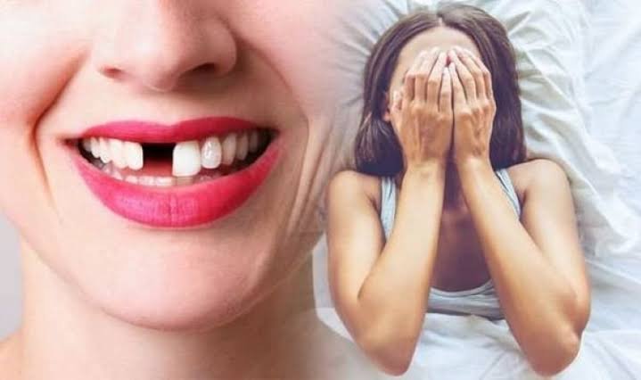Nằm mơ thấy gãy răng​