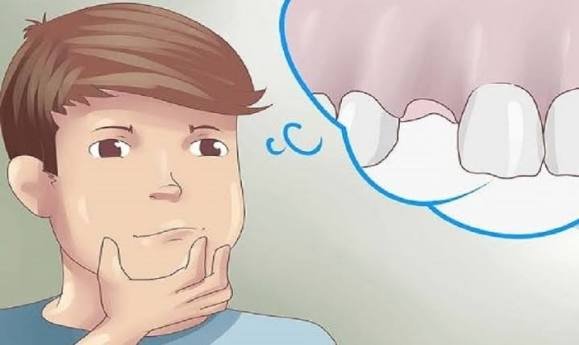 Nằm mơ thấy gãy răng​