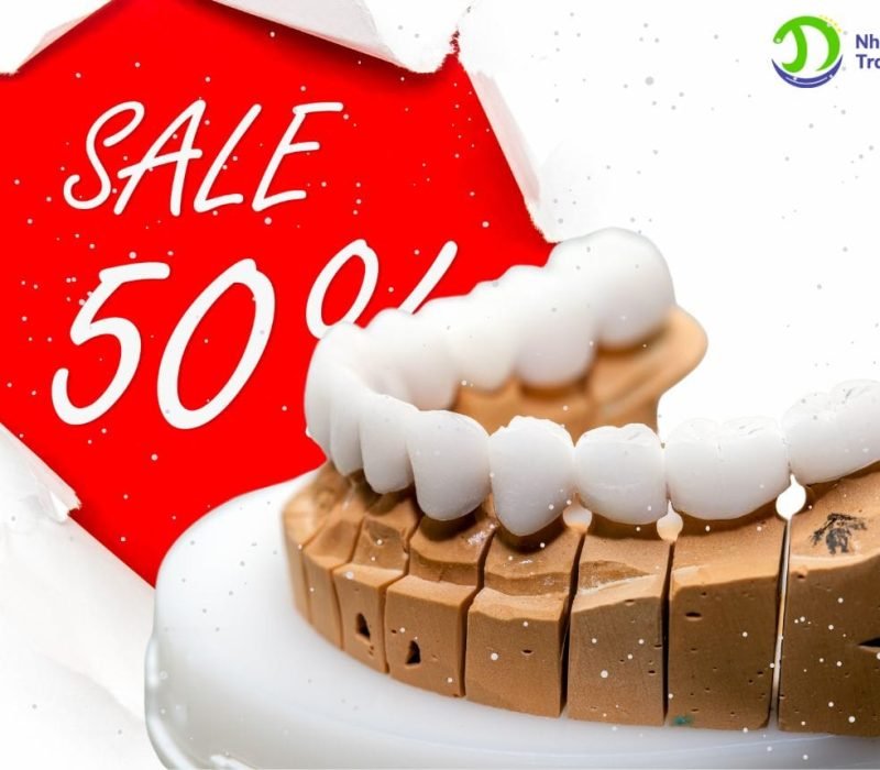 boc-rang-su-ca-ham Bọc răng sứ cả hàm với mô hình mẫu răng sứ với ưu đãi 50% của nha khoa Trang Dung